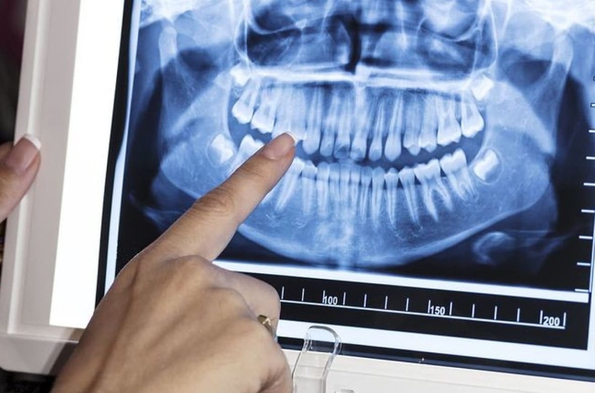 Рентген детских зубов в «My Smile»
