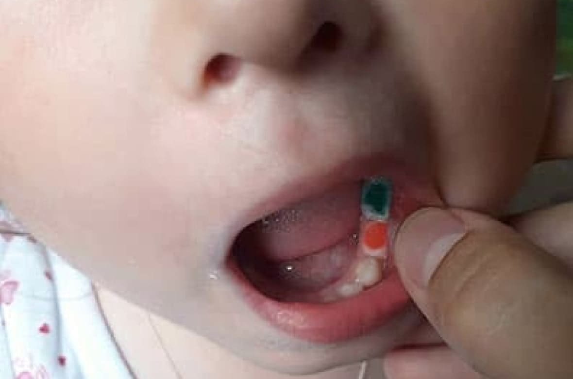 Как лечить зубы ребенку если он боится?