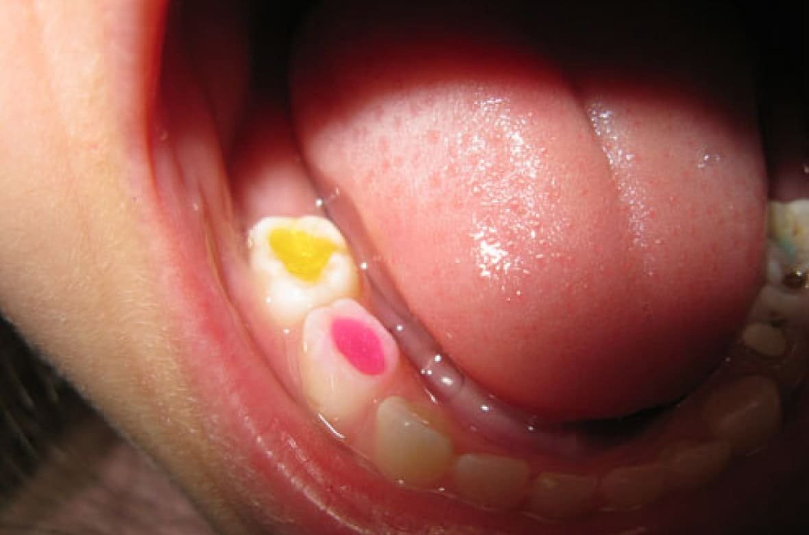 Що робити, якщо дитина боїться стоматолога?
