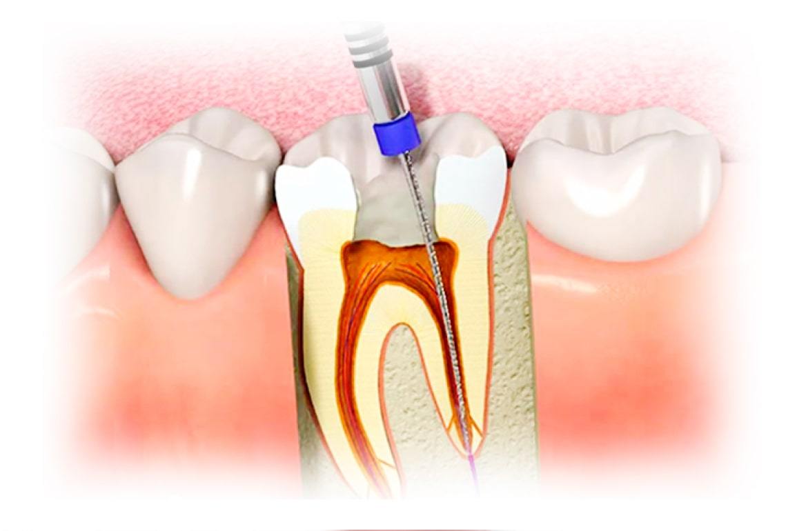 Особенности анатомии пульпы зуба