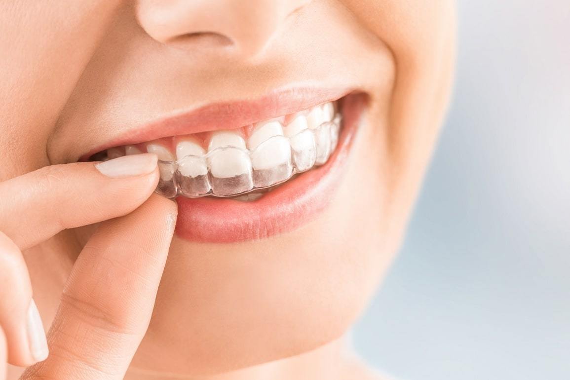 Методы лечения, которые использует стоматолог-ортодонт в «My Smile»