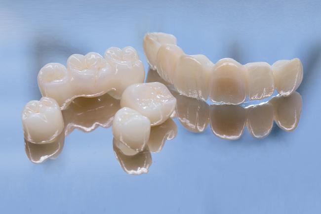 Зубная коронка из циркония: этапы установки