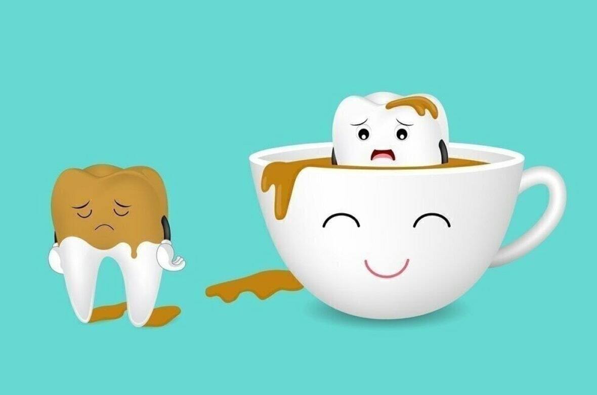 Что нельзя делать после чистки зубов